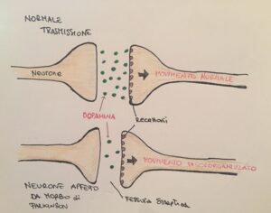 Parkinson