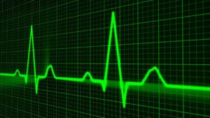 incremento delle pulsazioni cardiache durante l'attività fisica