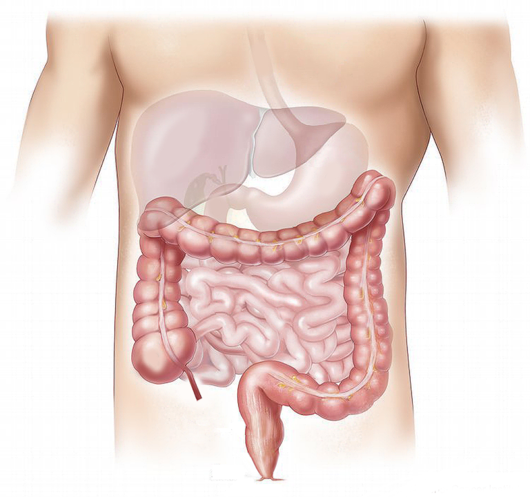 colon irritabile