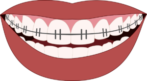 Osteopatia e ortodonzia