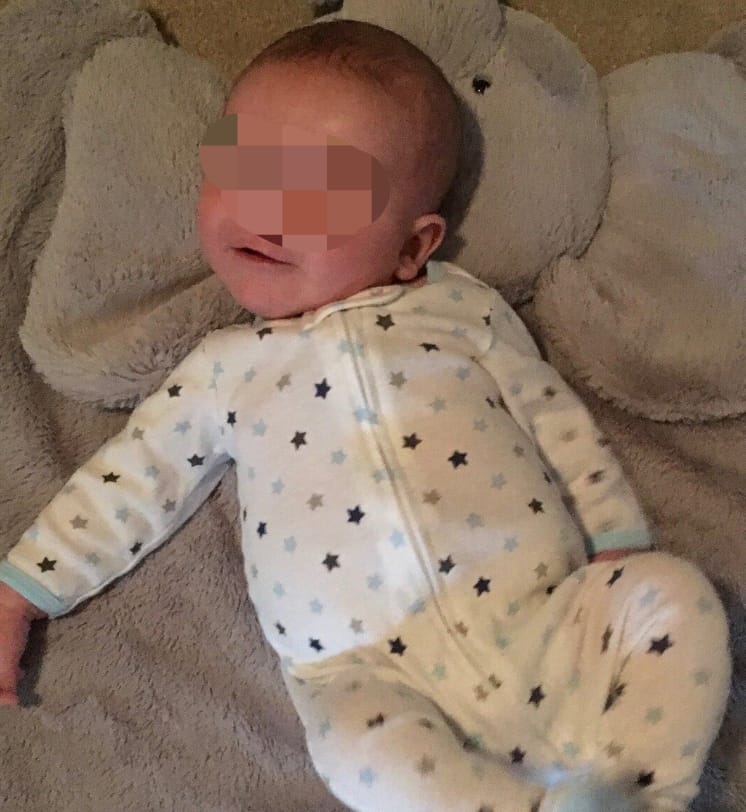 Torcicollo del neonato